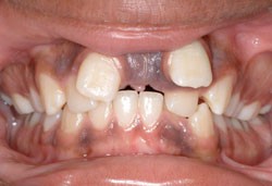 Front-IntraoralPhoto-2014.jpg